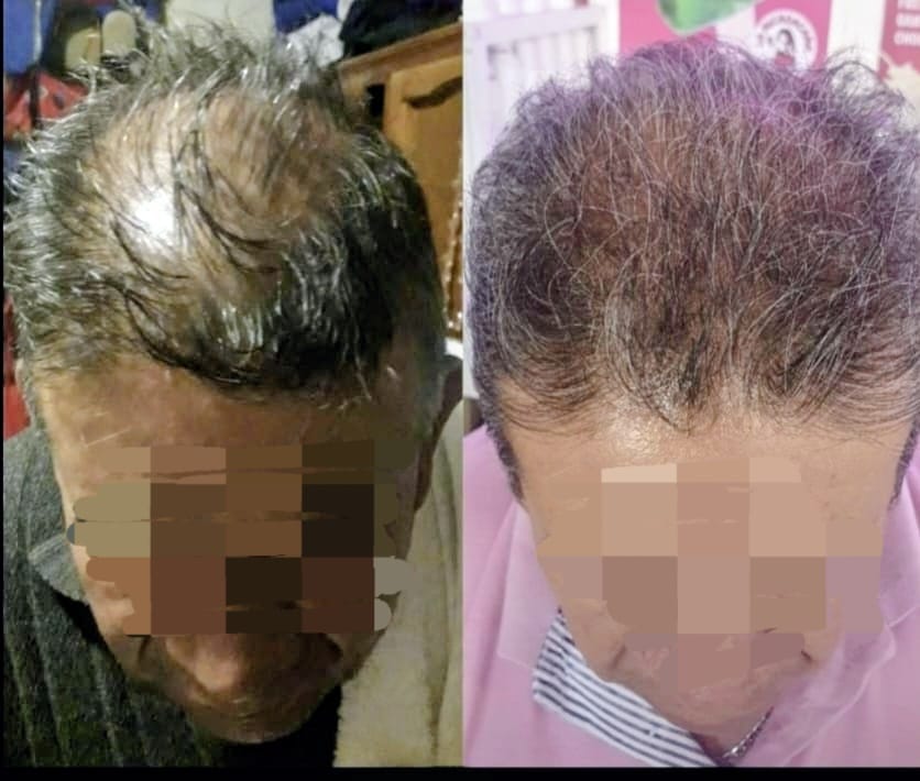 Terapia Integral Capilar